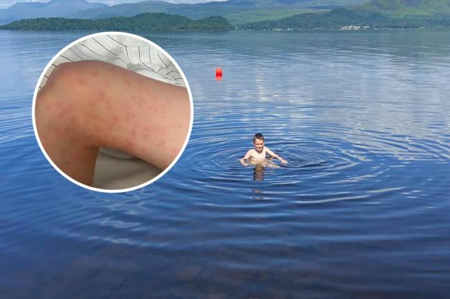 Loch Lomond: Children 'screaming in pain' after 'parasite' contact while swimming